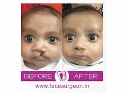 No.1 Plastic Surgery Hospital in India - Image 1