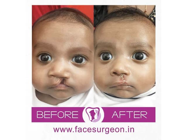 No.1 Plastic Surgery Hospital in India