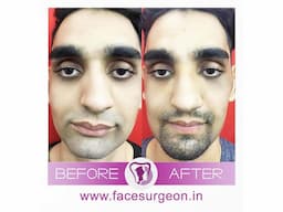 No.1 Plastic Surgery Hospital in India - Image 2
