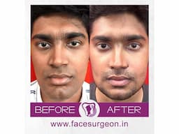 No.1 Plastic Surgery Hospital in India - Image 3