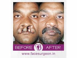 No.1 Plastic Surgery Hospital in India - Image 4