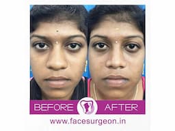 No.1 Plastic Surgery Hospital in India - Image 5