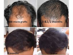 No.1 Plastic Surgery Hospital in India - Image 6