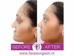 No.1 Plastic Surgery Hospital in India - Image 7