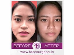 No.1 Plastic Surgery Hospital in India - Image 8