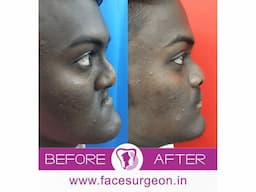 No.1 Plastic Surgery Hospital in India - Image 9