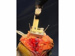 Best Knee Replacement in Meerut - Image 2