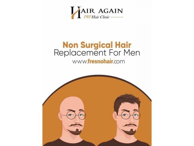 Non Surgical Hair Replacement For Men