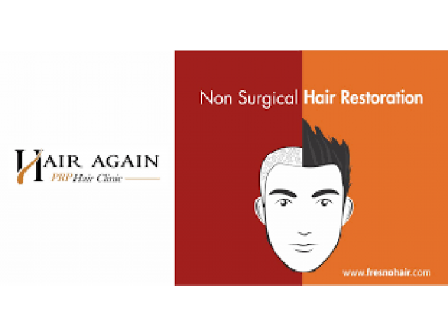 Non Surgical Hair Restoration