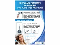 Root Canal Treatment (RCT) at Jamnagar Dr. Bharat Katarmal Dental Clinic - Image 8