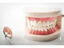 General dental services in Kelowna - Image 3