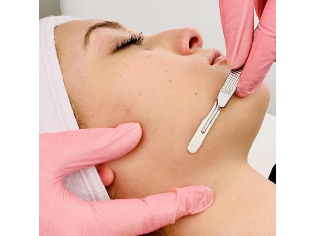 Laser Hair Remoual / Skin Rejuvenation Treatments