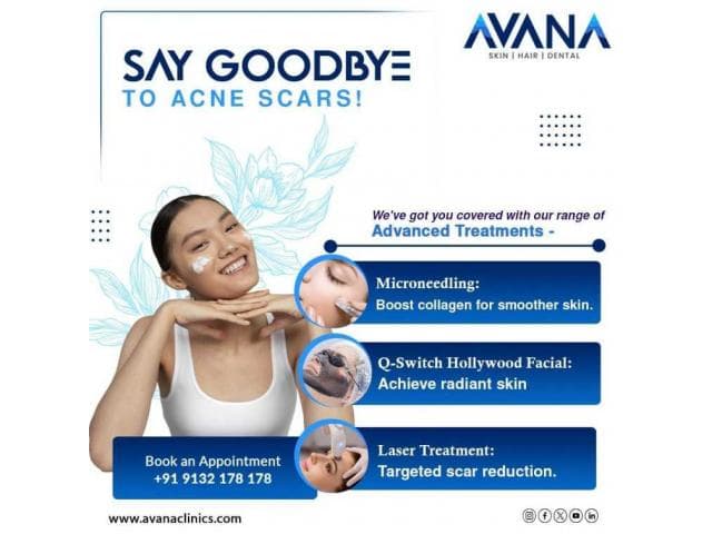 Best skin and hair clinic in Hyderabad