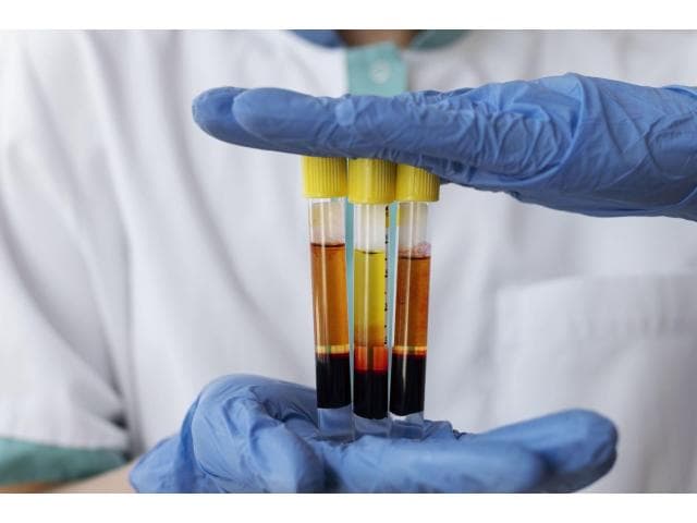 Now Offering Advanced PCR Urine Culture Testing – Book Today!