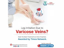 Varicose veins Doctor in Tirupati - Image 1