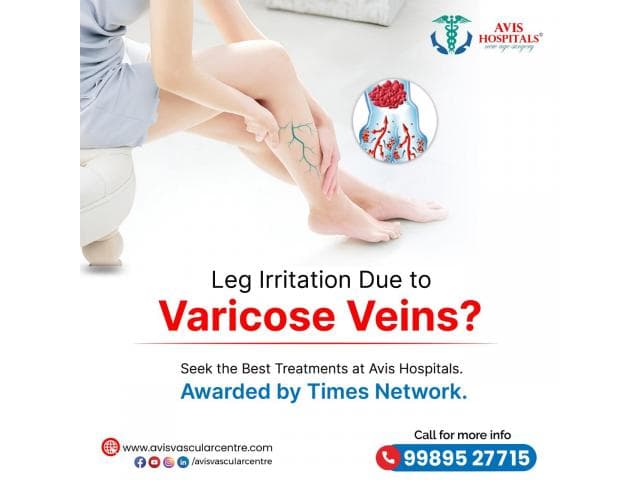 Varicose veins Doctor in Tirupati