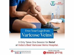 Varicose veins Doctor in Tirupati - Image 4