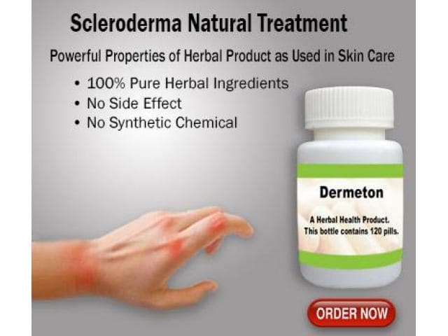 Natural Treatment for Scleroderma
